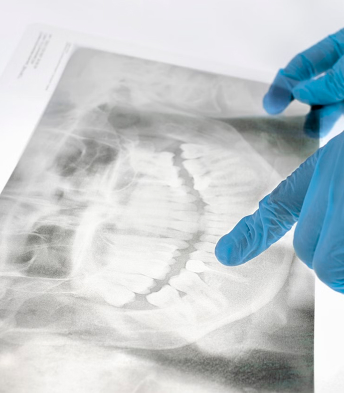 Close up of an x-ray being examined by an orthodontist with blue latex gloves