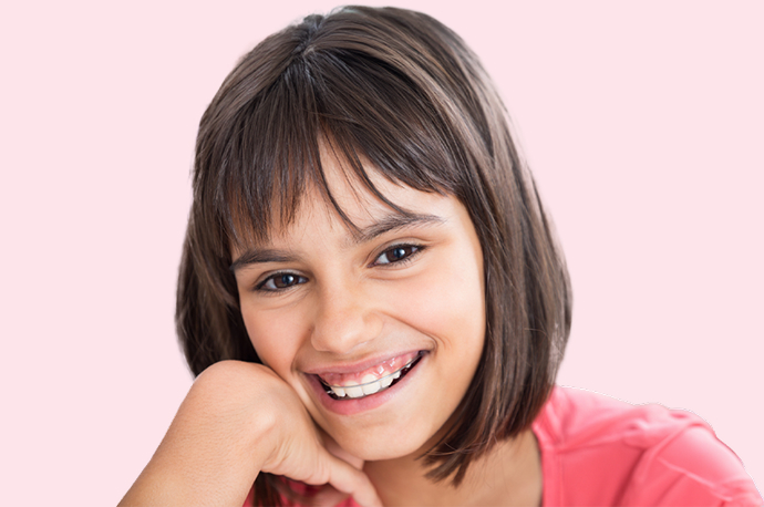 Young girl smiling in a metal removable retainer after receiving phase 1 orthodontic treatment